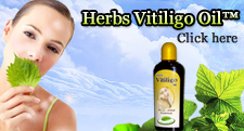 Vitiligo Treatment With Herbs Vitiligo oil
