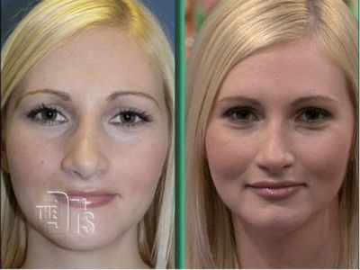 Cosmetic surgery Las Vegas