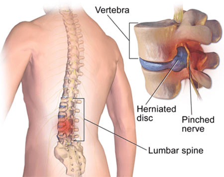 Lower & Upper Back Pain Relief