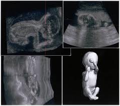 3d ultrasound center Texas