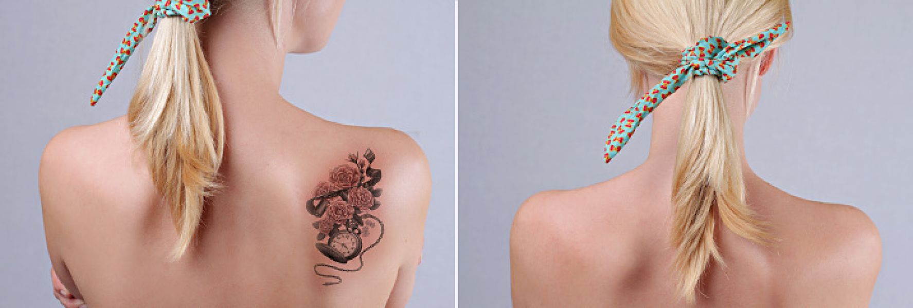 Picosure Tattoo Removal Sugar LandNear To Me - Pamela Carr 
