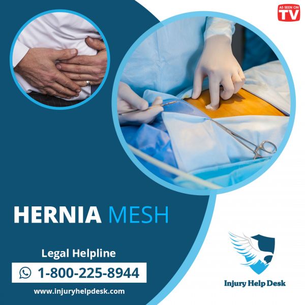 Hernia mesh failures generate recalls, lawsuits