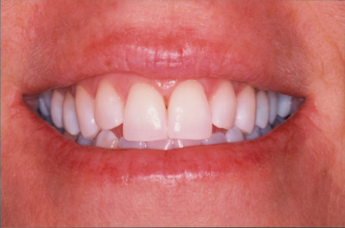 Looking For Local General Dentistry Atlanta GA ? Visit Dr. Michaela McKenzie 