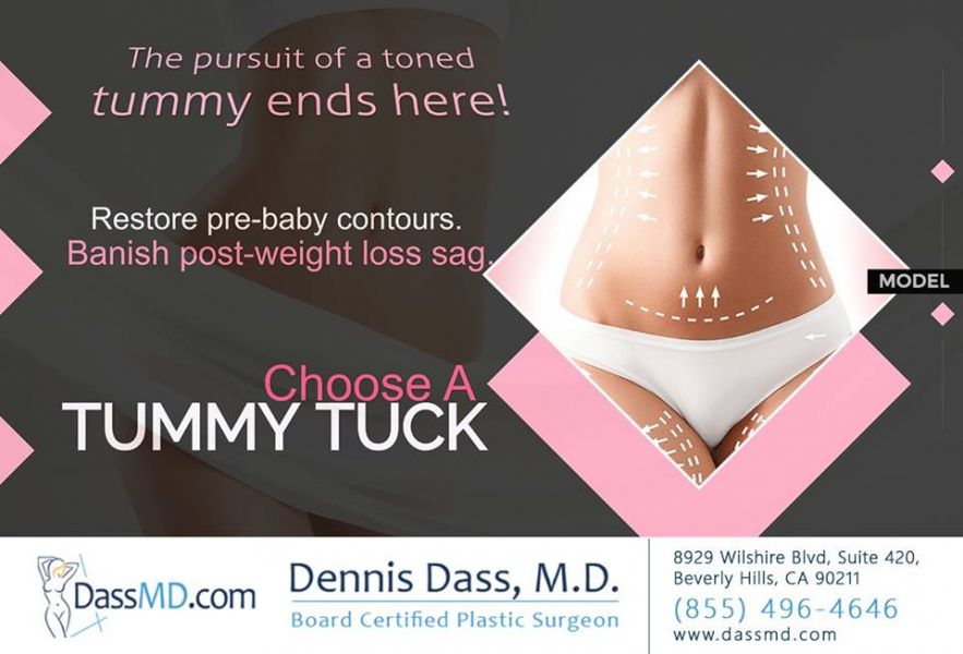 Tummy Tuck Beverly Hills CA Near Me - Dr. Dennis Dass 