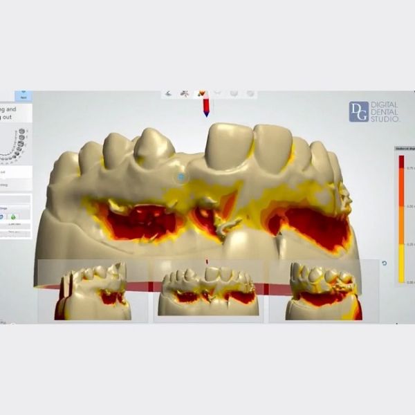 Abutment Dental Paterson