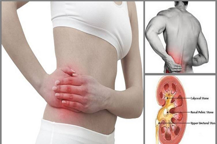 Kidney Stone Treatment In Pune | Psoriasis Treatment In Pune