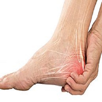 Achilles Tendonitis Treatment Center