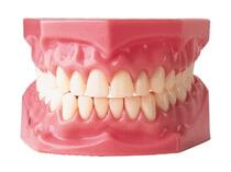 Dentures San Jose Nearest To Me - Dr. Munira Lokhandwala 