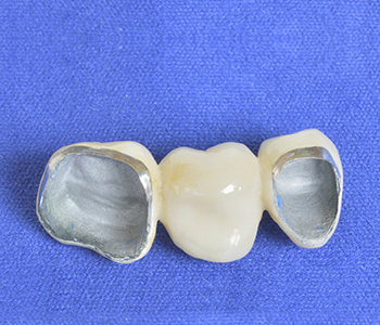Dr. Mario Castellanos Affordable Cosmetic Dental Care in La Mirada - 91730